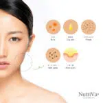 NUTRIVA® AC REDUCE ACNE SCARS AND DARK SPOTS - Image 3