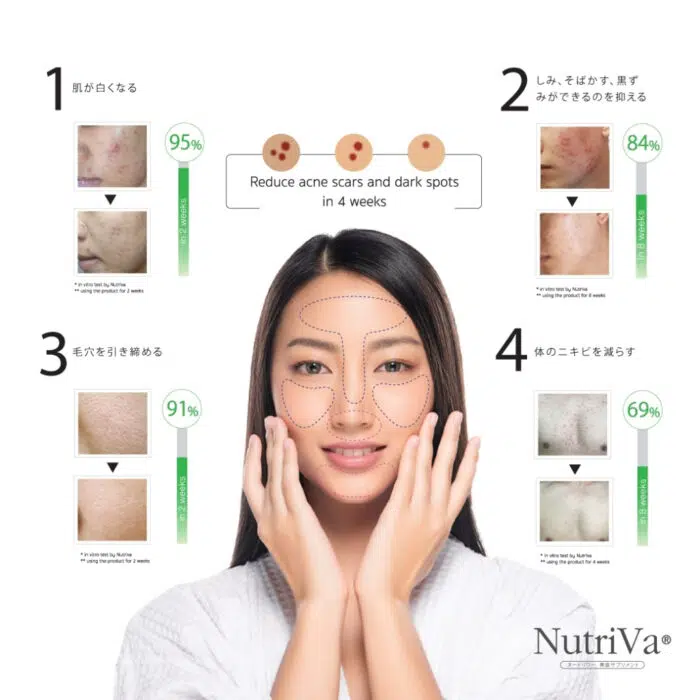 NUTRIVA® AC REDUCE ACNE SCARS AND DARK SPOTS - Image 2